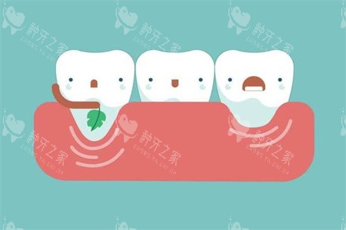 牙齿治疗过程卡通图