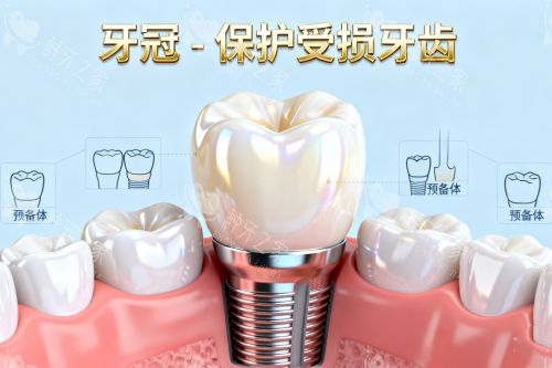 种植牙植入卡通一览