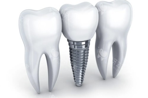 种植牙选奥齿泰还是皓圣？一文读懂两大品牌差异