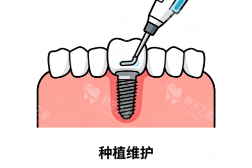 德国朗斯种植牙为啥在国内不常见？真相大揭秘