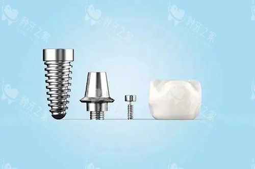 登特斯种植牙好不好用？真实用户反馈与多样化解析