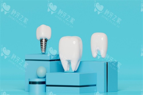 嘉兴曙光口腔种牙贵吗？价格明细+技术实力一览