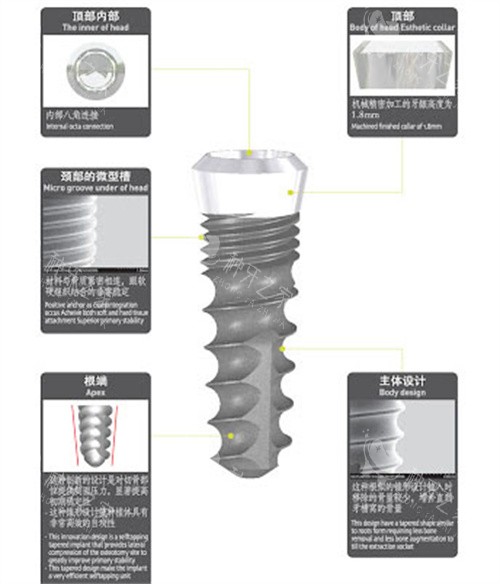 韩国SG种植体详细介绍
