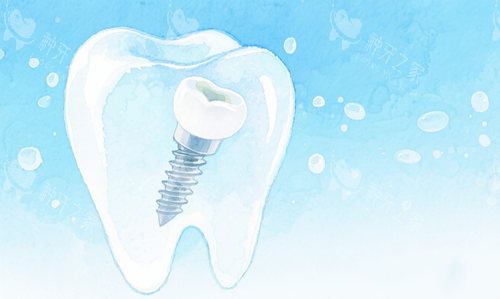 种植牙价格差距大揭秘:贵的和便宜的究竟差在哪?