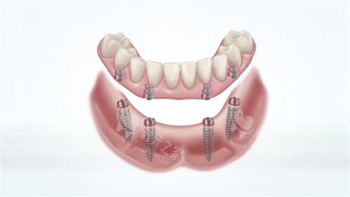 马泷桥修复结构图