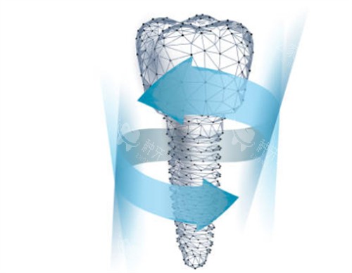 做了种植牙后悔死了?我的亲身经历实测:不存在的!