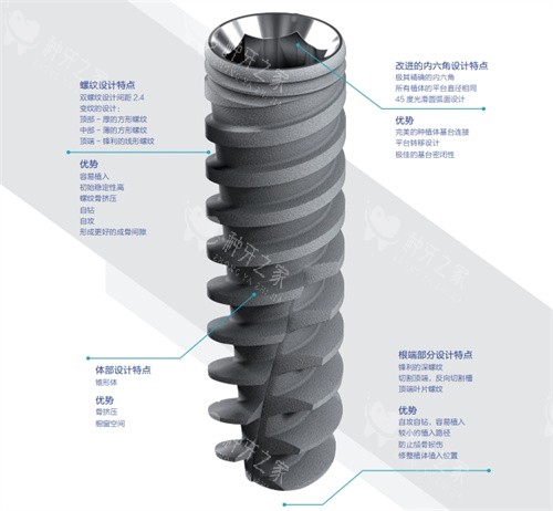 以色列雅定种植体优缺点解析：更适合你的种植方案！