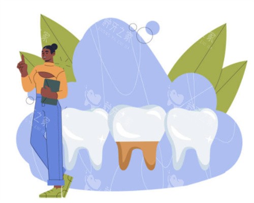 种植牙模拟图 种植牙模拟图