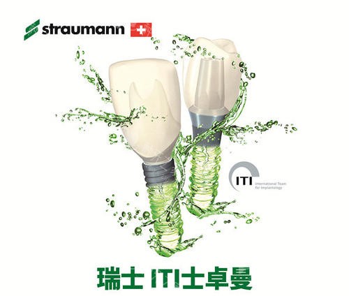 种植牙诺贝尔和ITI哪个好？揭秘ITI和诺贝尔差别