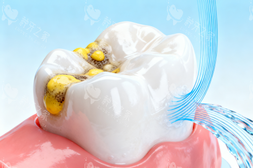 海宁圣麦口腔种植牙价格参考，电话地址全公开！