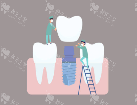 2026上海种植牙价格表：单颗种牙报价3980+